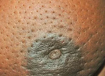 MAB-health-screening